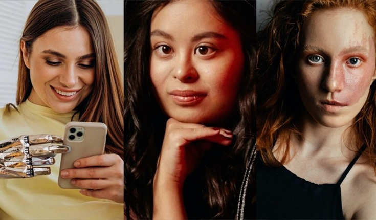 As modelos com deficiência ou aparência alternativa que quebram barreiras