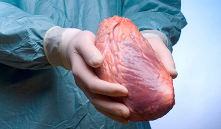 Pessoas transplantadas terão atendimento preferencial em Parauapebas