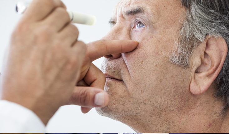 Cirurgia de catarata pode reduzir risco de desenvolver demência