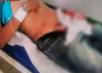 Tentativa de homicídio no Bairro Casas Populares II